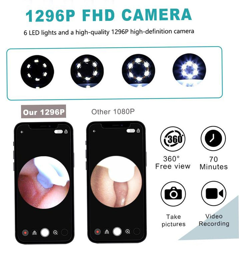 [FONENYCA] Ear Wax Removal Kit with Light Ear Camera 6 Ear Spoon for Ios & Android Earpick Flashlight Black Thanksgiving Christmas Gift Set